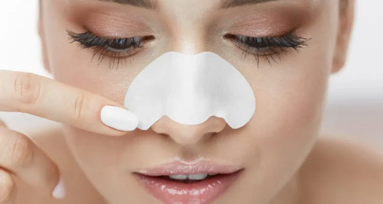 Tips Mencegah Komedo agar Wajah Tetap Bersih dan Sehat